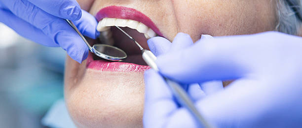 Best Urgent Care for Lost Fillings or Crowns in Meadowbrook, VA